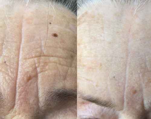 Lift Serum 2 φασεων My Image