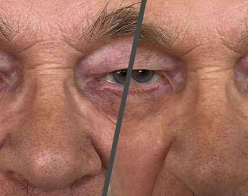 Lift Serum 2 φασεων My Image